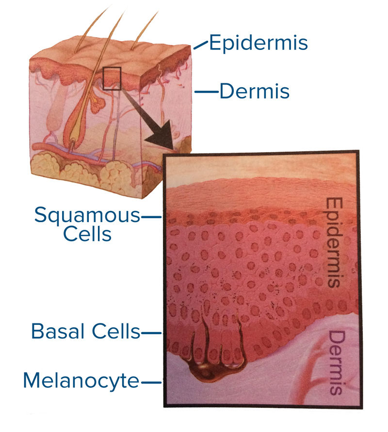 Skin Cancer: Highly Skilled Care of Head, Face and Neck Melanoma